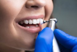 Методы чистки зубов в современной стоматологии